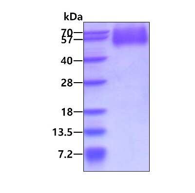 SDS-PAGE: Recombinant Human CD34 His Protein [NBP2-53044]